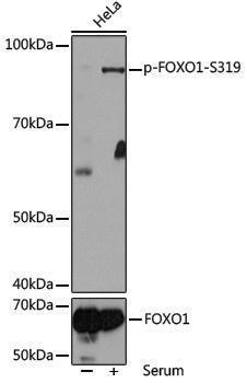 Anti-Phospho-FOXO1 (Ser319) Rabbit pAb