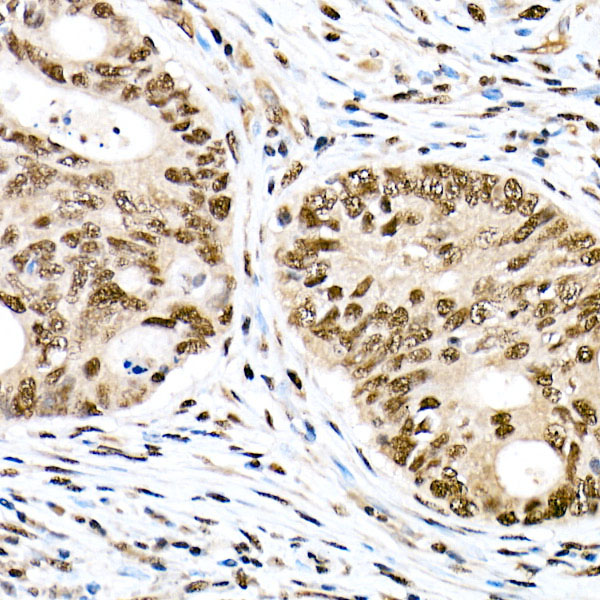 Anti-Phospho-FOXO1 (Ser319) Rabbit pAb
