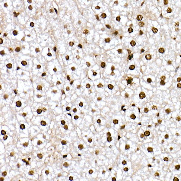 Anti-Phospho-FOXO1 (Ser319) Rabbit pAb