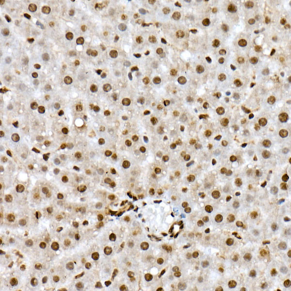 Anti-Phospho-FOXO1 (Ser319) Rabbit pAb