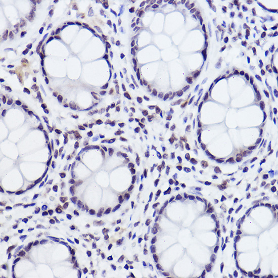Anti-Phospho-c-Jun (Ser243) Rabbit pAb