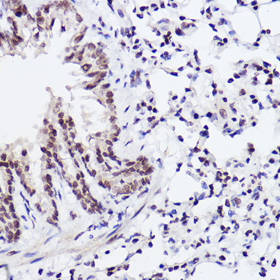 Anti-Phospho-c-Jun (Ser243) Rabbit pAb