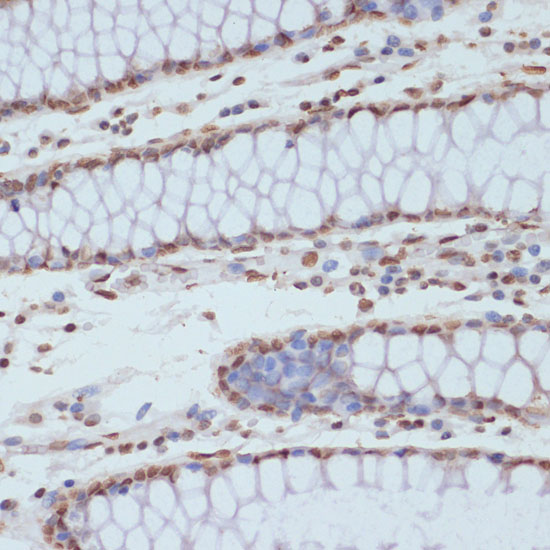 Anti-Phospho-CDK1 (Tyr15) Rabbit pAb
