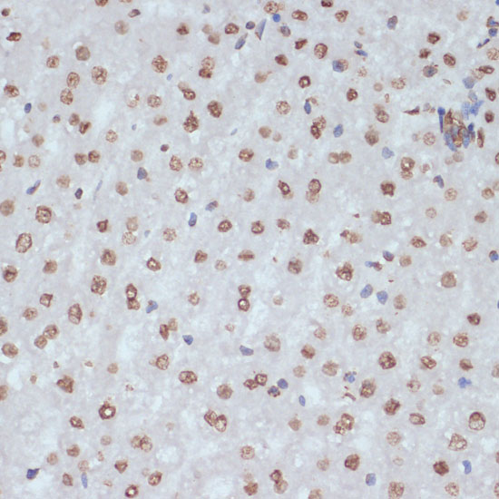 Anti-Phospho-CDK1 (Tyr15) Rabbit pAb