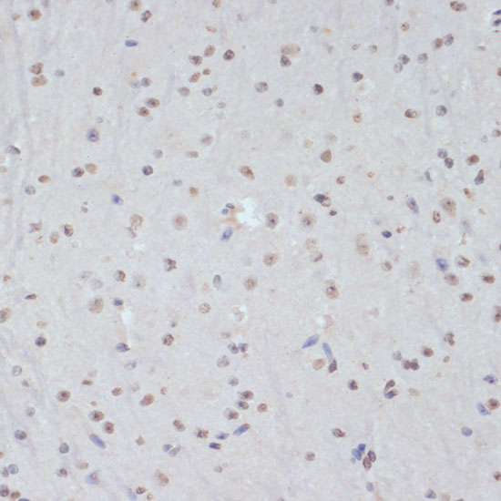 Anti-Phospho-CDK1 (Tyr15) Rabbit pAb