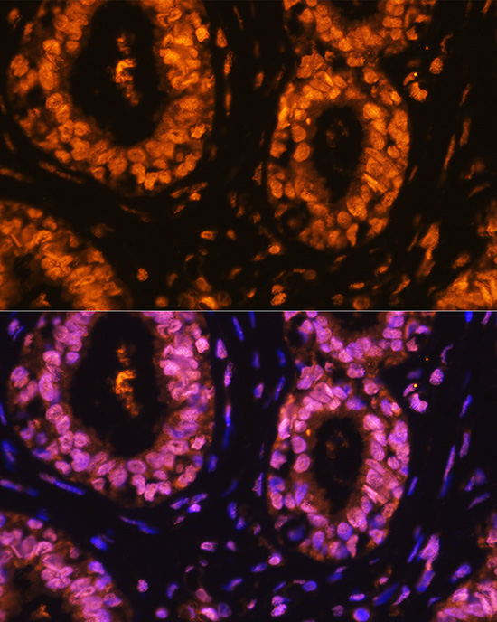 Anti-Phospho-CDK1 (Tyr15) Rabbit pAb