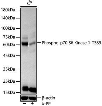 Anti-Phospho-S6K1 (Thr389) Rabbit pAb