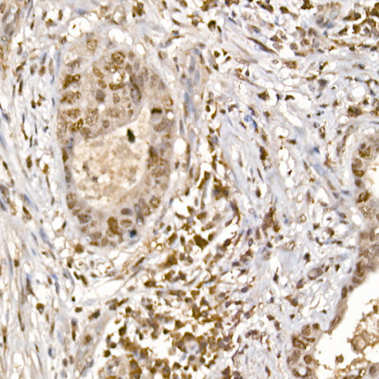 Anti-Phospho-S6K1 (Thr389) Rabbit pAb