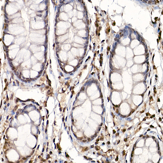 Anti-Phospho-S6K1 (Thr389) Rabbit pAb