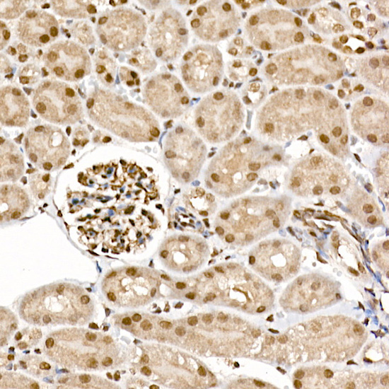Anti-Phospho-S6K1 (Thr389) Rabbit pAb