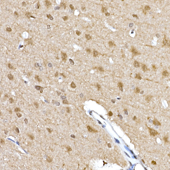 Anti-Phospho-S6K1 (Thr389) Rabbit pAb