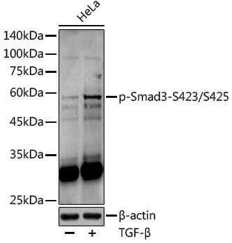 Anti-Phospho-Smad3 (Ser425) Rabbit pAb