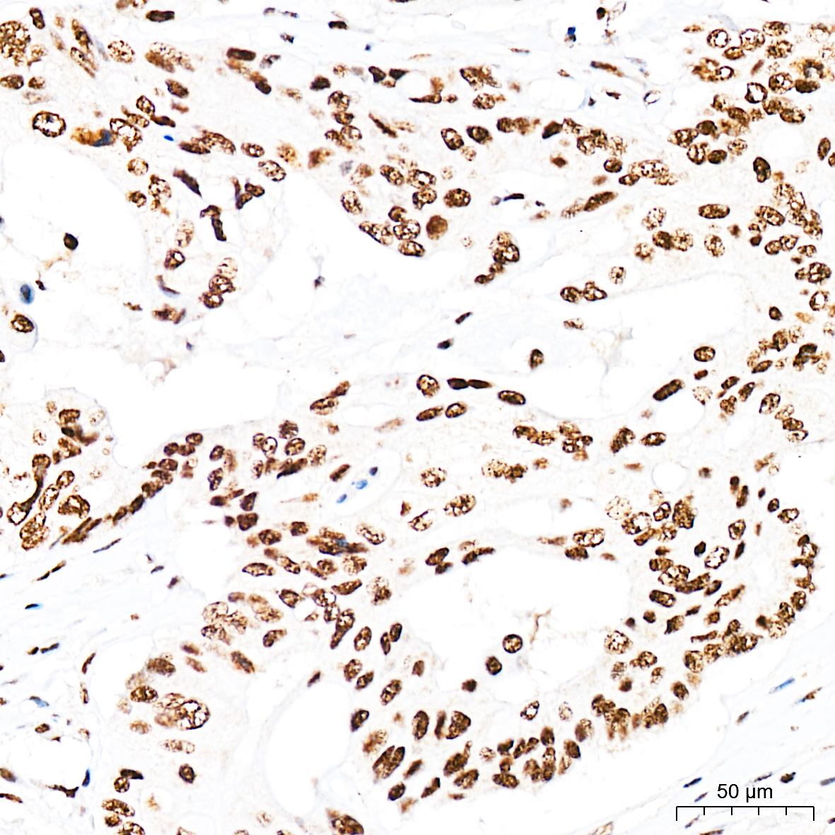 Anti-Phospho-Smad3 (Ser425) Rabbit pAb