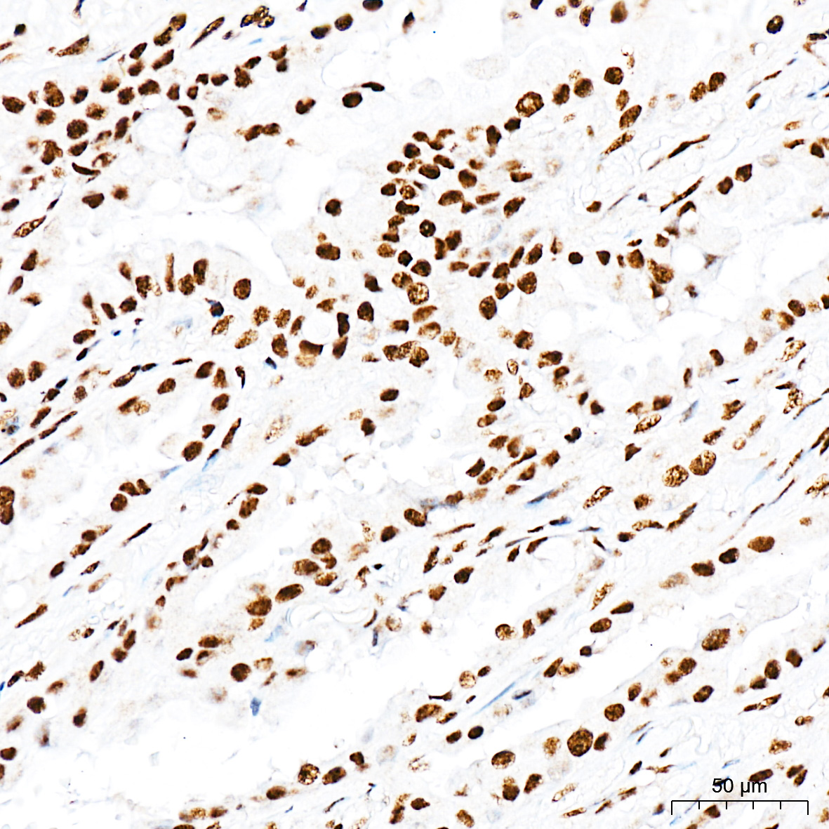 Anti-Phospho-Smad3 (Ser425) Rabbit pAb