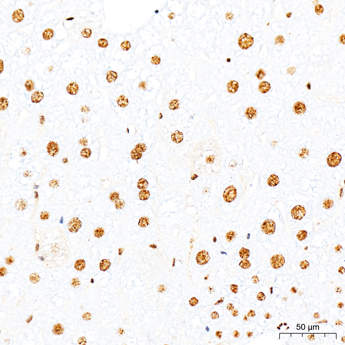Anti-Phospho-Smad3 (Ser425) Rabbit pAb