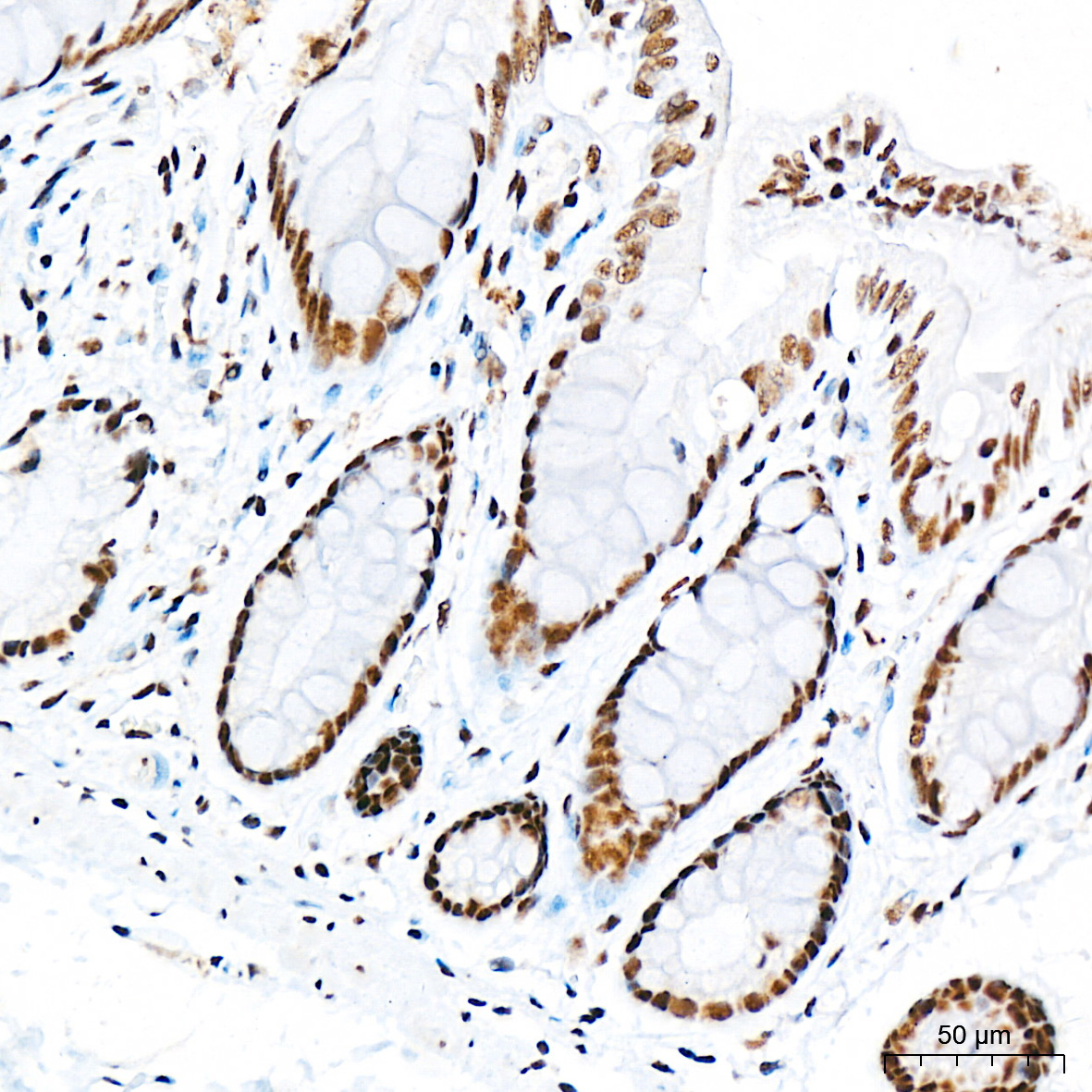 Anti-Phospho-Smad3 (Ser425) Rabbit pAb