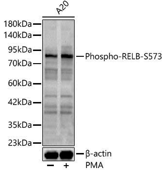 Anti-Phospho-Rel B (Ser573) Rabbit pAb