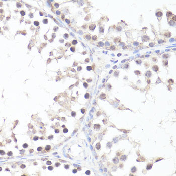 Anti-Phospho-c-Myc (Thr58) Rabbit pAb