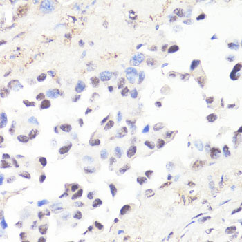 Anti-Phospho-c-Myc (Thr58) Rabbit pAb