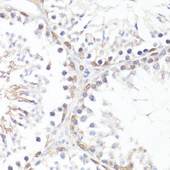 Anti-Phospho-c-Myc (Thr58) Rabbit pAb