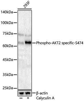 Anti-Phospho-AKT2 (Ser474) Rabbit pAb