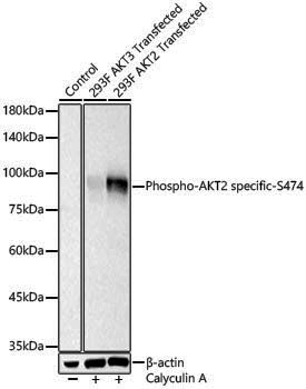 Anti-Phospho-AKT2 (Ser474) Rabbit pAb