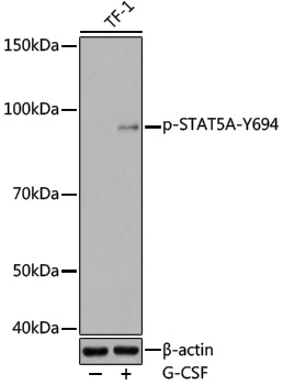 Anti-Phospho-STAT5a (Tyr694) Rabbit pAb