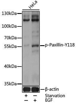 Anti-Phospho-Paxillin (Tyr118) Rabbit pAb