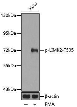 Anti-Phospho-LIMK2 (Thr505) Rabbit pAb