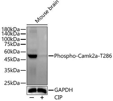 Anti-Phospho-CaMK II alpha (Thr286) Rabbit pAb