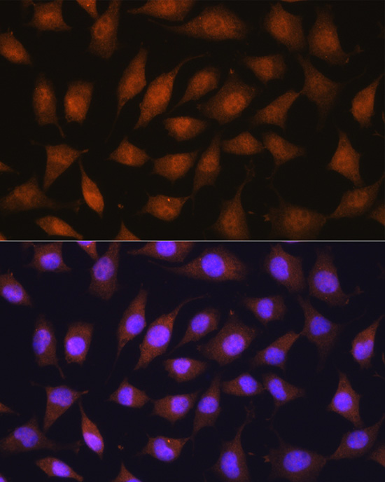 Anti-67kDa Laminin Receptor Rabbit pAb