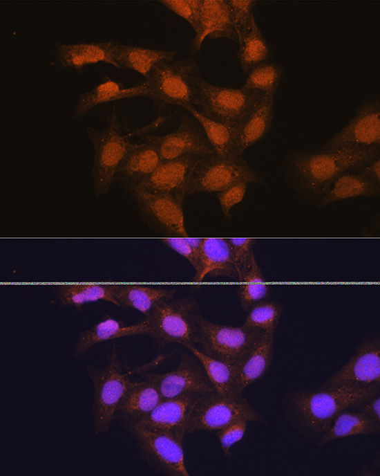 Anti-67kDa Laminin Receptor Rabbit pAb