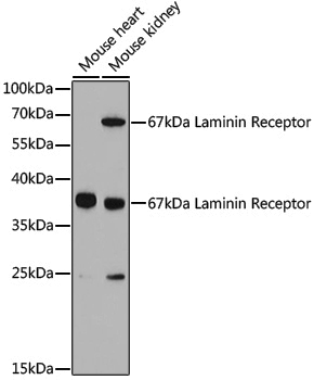 Anti-67kDa Laminin Receptor Rabbit pAb