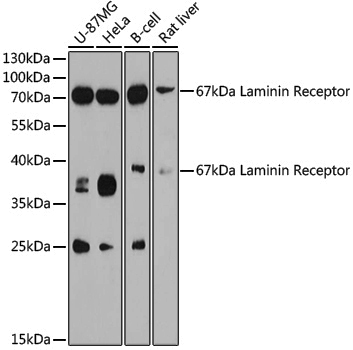 Anti-67kDa Laminin Receptor Rabbit pAb