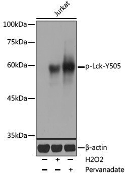 Anti-Phospho-Lck (Tyr505) Rabbit pAb