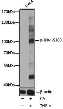 Anti-Phospho-IKK alpha (Ser180) Rabbit pAb