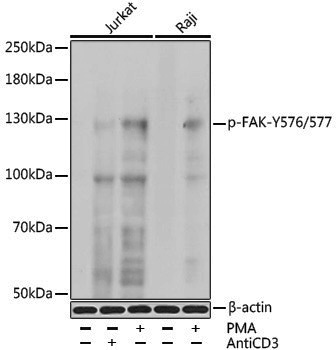 Anti-Phospho-FAK (Tyr576/Tyr577) Rabbit pAb