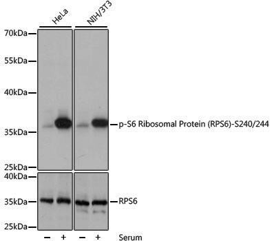 Anti-Phospho-RPS6 (Ser240/Ser244) Rabbit pAb