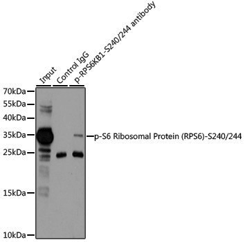 Anti-Phospho-RPS6 (Ser240/Ser244) Rabbit pAb
