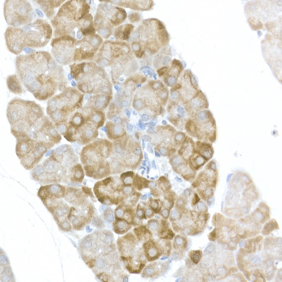 Anti-Phospho-RPS6 (Ser240/Ser244) Rabbit pAb