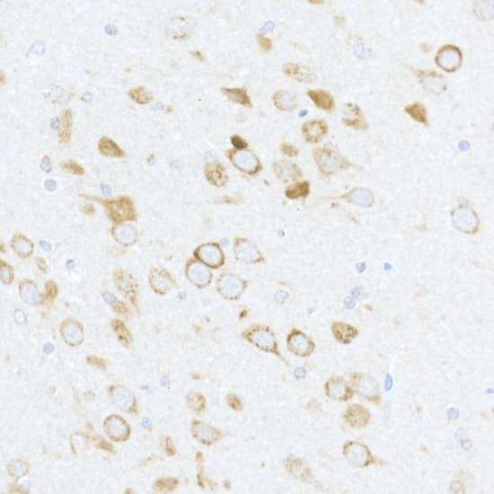 Anti-Phospho-RPS6 (Ser240/Ser244) Rabbit pAb