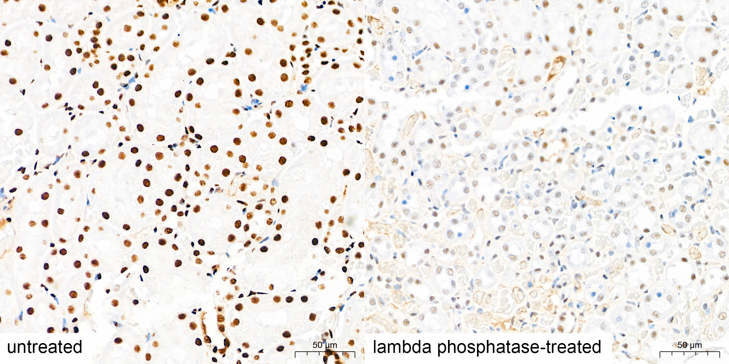Anti-Phospho-IRS1 (Ser307) Rabbit pAb