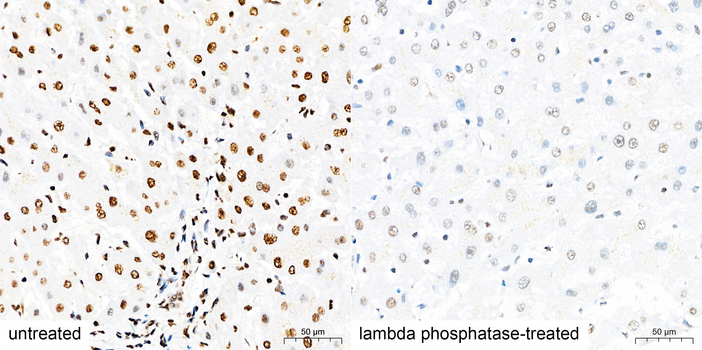 Anti-Phospho-IRS1 (Ser307) Rabbit pAb