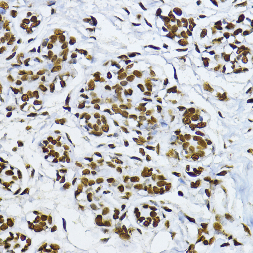Anti-Phospho-Smad3 (Ser425) Rabbit pAb