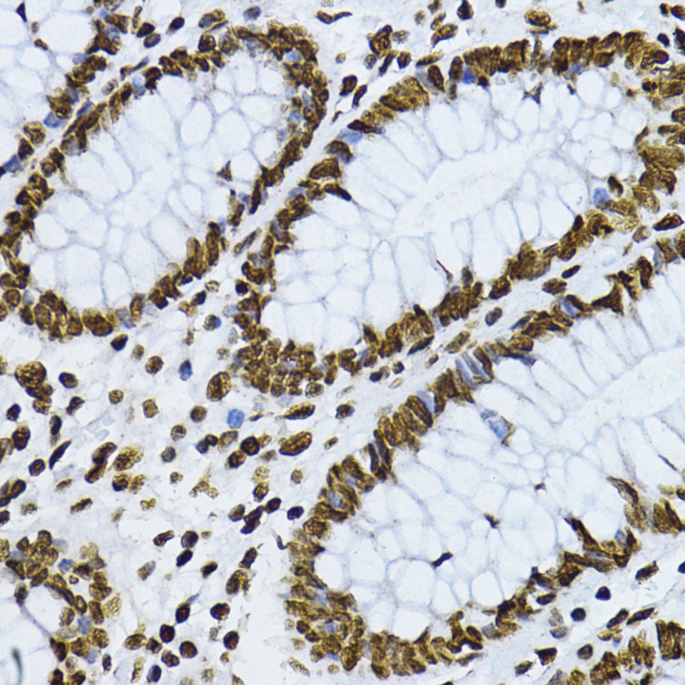 Anti-Phospho-Smad3 (Ser425) Rabbit pAb