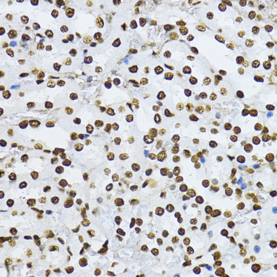 Anti-Phospho-Smad3 (Ser425) Rabbit pAb