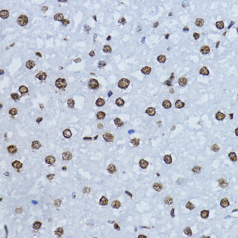 Anti-Phospho-Smad3 (Ser425) Rabbit pAb