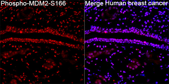 Anti-Phospho-MDM2 (Ser166) Rabbit pAb