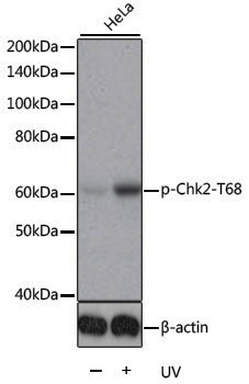 Anti-Phospho-Chk2 (Thr68) Rabbit pAb
