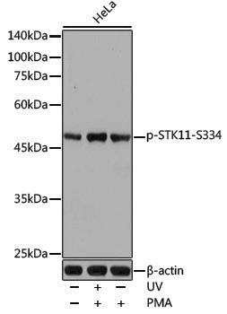 Anti-Phospho-LKB1 (Ser334) Rabbit pAb